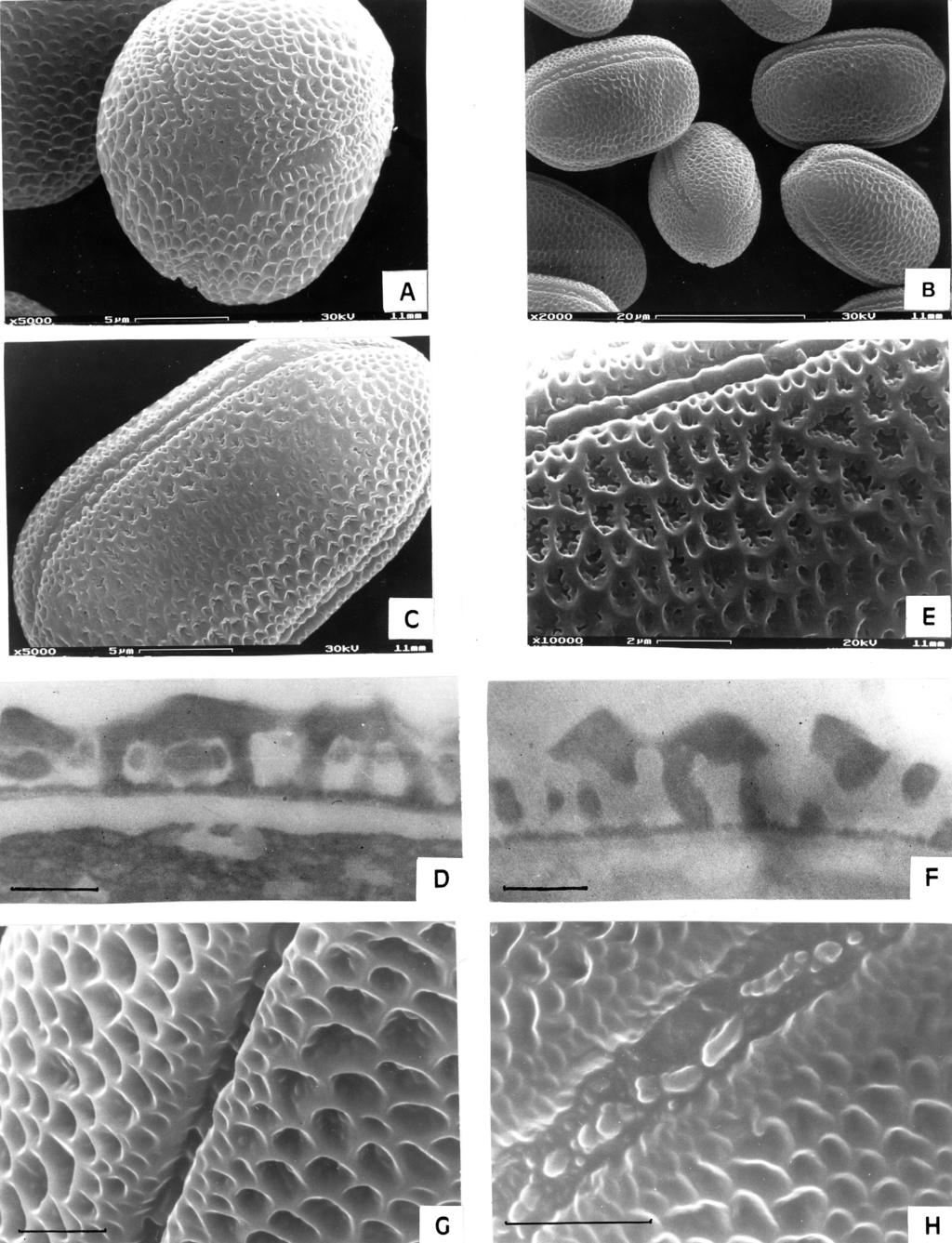 ANN. BOT. FENNICI 37 Pollen morphology of Onobrychis and Hedysarum 211 Fig. 2. A D: Onobrychis gracilis. A: SEM polar view and ornamentation in apocolpium. Scale bar = 5 µm.