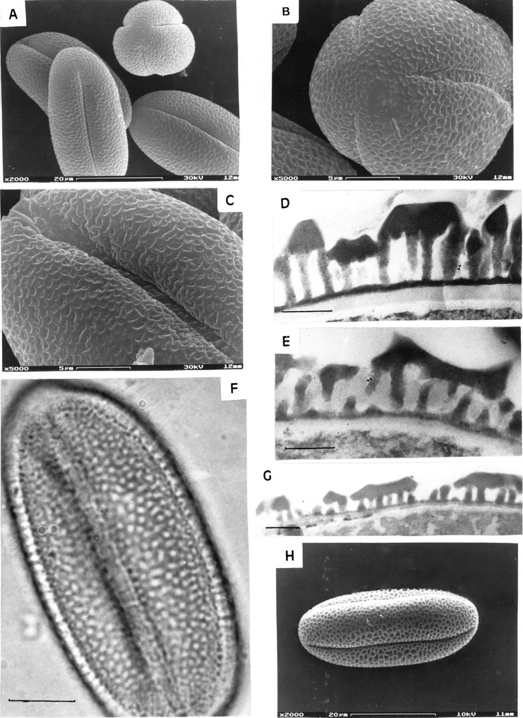 ANN. BOT. FENNICI 37 Pollen morphology of Onobrychis and Hedysarum 213 Fig. 3. A E: Onobrychis caput-galli. A: SEM polar view and outline. Scale bar = 20 µm. B: SEM apocolpium and ornamentation.