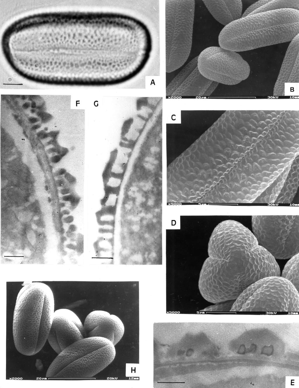 ANN. BOT. FENNICI 37 Pollen morphology of Onobrychis and Hedysarum 215 Fig. 5. A E: Onobrychis lasiostachya. A: LM colpus and ornamentation. Scale bar = 4µm. B: SEM apocolpium. Scale bar = 20 µm.