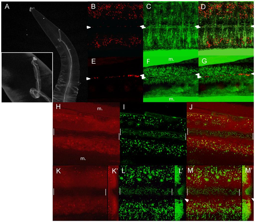 Wolbachia Transmission in Brugia malayi Figure 6. Detection of Wolbachia by propidium iodide in the lumen of the secretory-excretory canal.