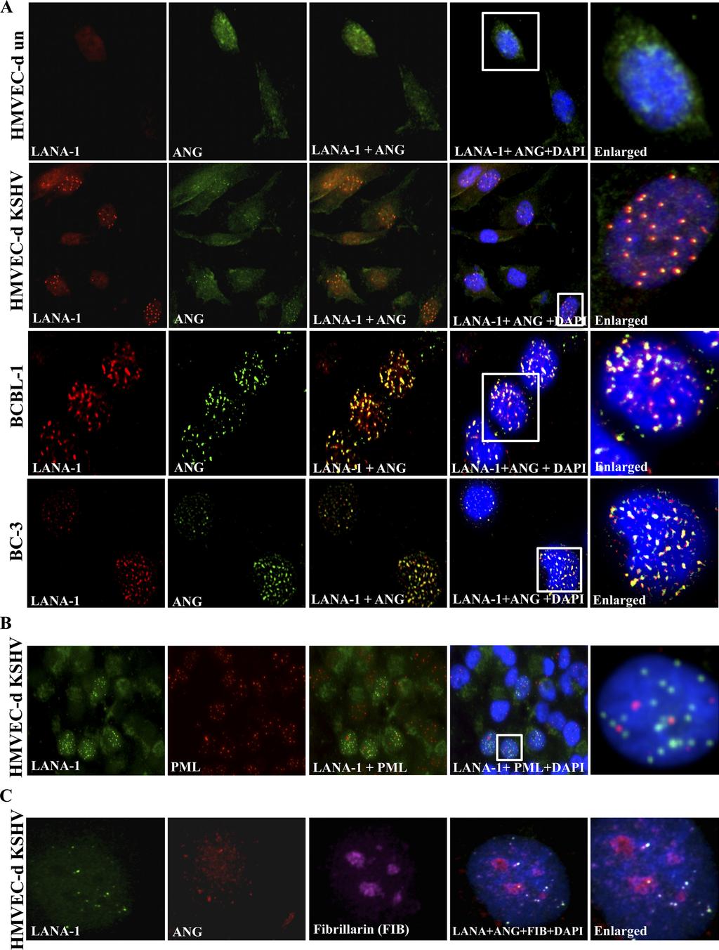 Paudel et al. FIG 2 LANA-1 colocalization with ANG in the nucleus of KSHV-infected cells.