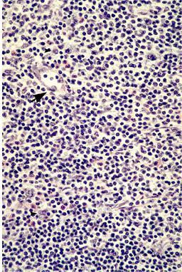 A paracortex with many lymphocytes and
