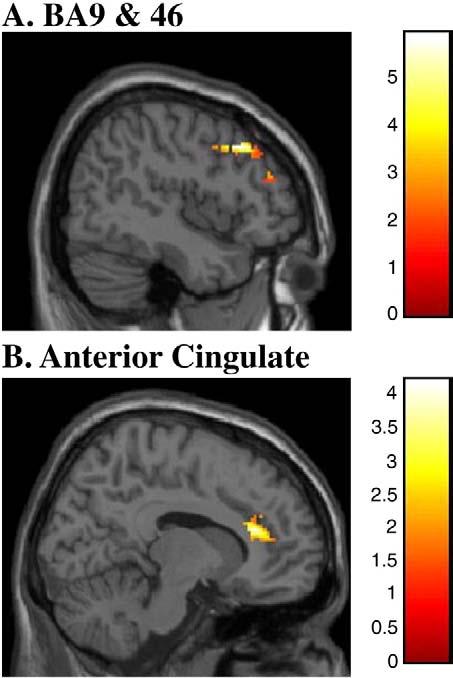 J.M. Hooley et al. / Psychiatry Research: Neuroimaging 172 (2009) 83 91 89 Fig. 4. Praise.