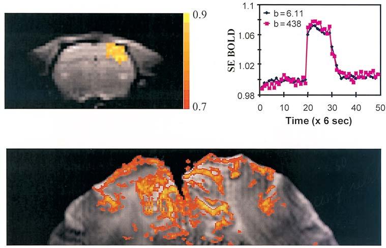 16 S.-G. Kim and P.A. Bandettini Figure 1.11. Spin-echo BOLD-based fmri at 9.4T and 7T. 41,72 (top) An a-chloralse anesthetized rat was used for somatosensory forelimb stimulation.