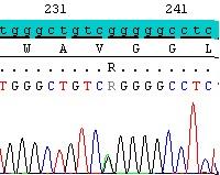 Mutation analysis of Patient 2 (B1) and Patient 3 (sibling) (B2) showed a homozygous mutation at c.