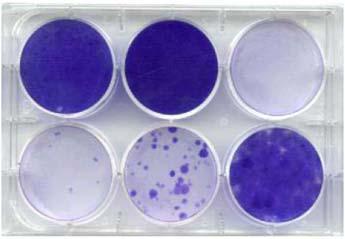 Virus stock titration- Methods Relative virus titer determination Relative infection unit (RIU)/ml Puromycin