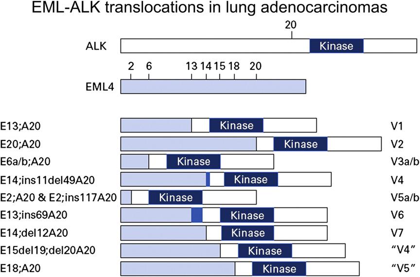Targeted Therapies in Lung Cancer 77 Recently, ALK rearrangements were identified in rare NSCLC cell lines and in isolated primary adenocarcinomas from Japanese and Chinese populations.
