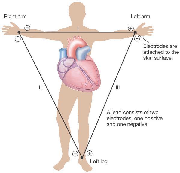Electrocardiogram (ECG):Electrical Activity of the Heart