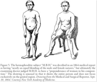 History of Intersex: America Mid 1800s Concentration on sex assignment, people with behaviors atypical were viewed as suspicious and deceptive Doctor exams at times would lead to reassignment,