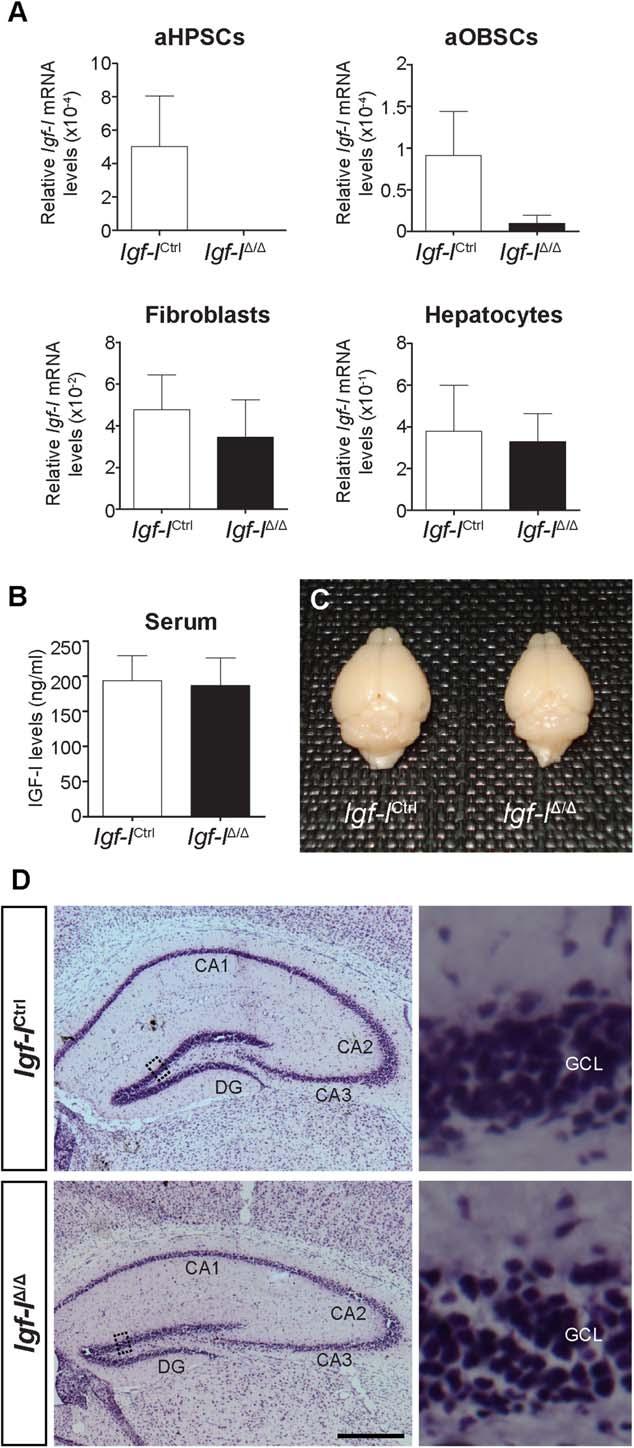 8 Brain IGF-I Regulates Hippocampal Neurogenesis 35, 36, 59]). Here we found a 0.67-fold and 2.