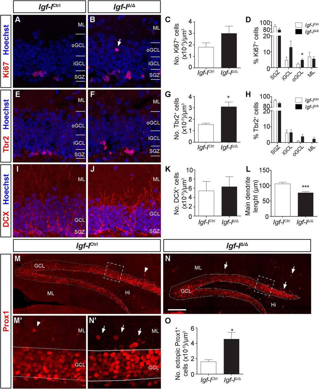 Nieto-Estevez, Oueslati-Morales, Li et al. 9 Figure 6. A nervous system-specific Igf-I deletion impairs postnatal/adult hippocampal neurogenesis.