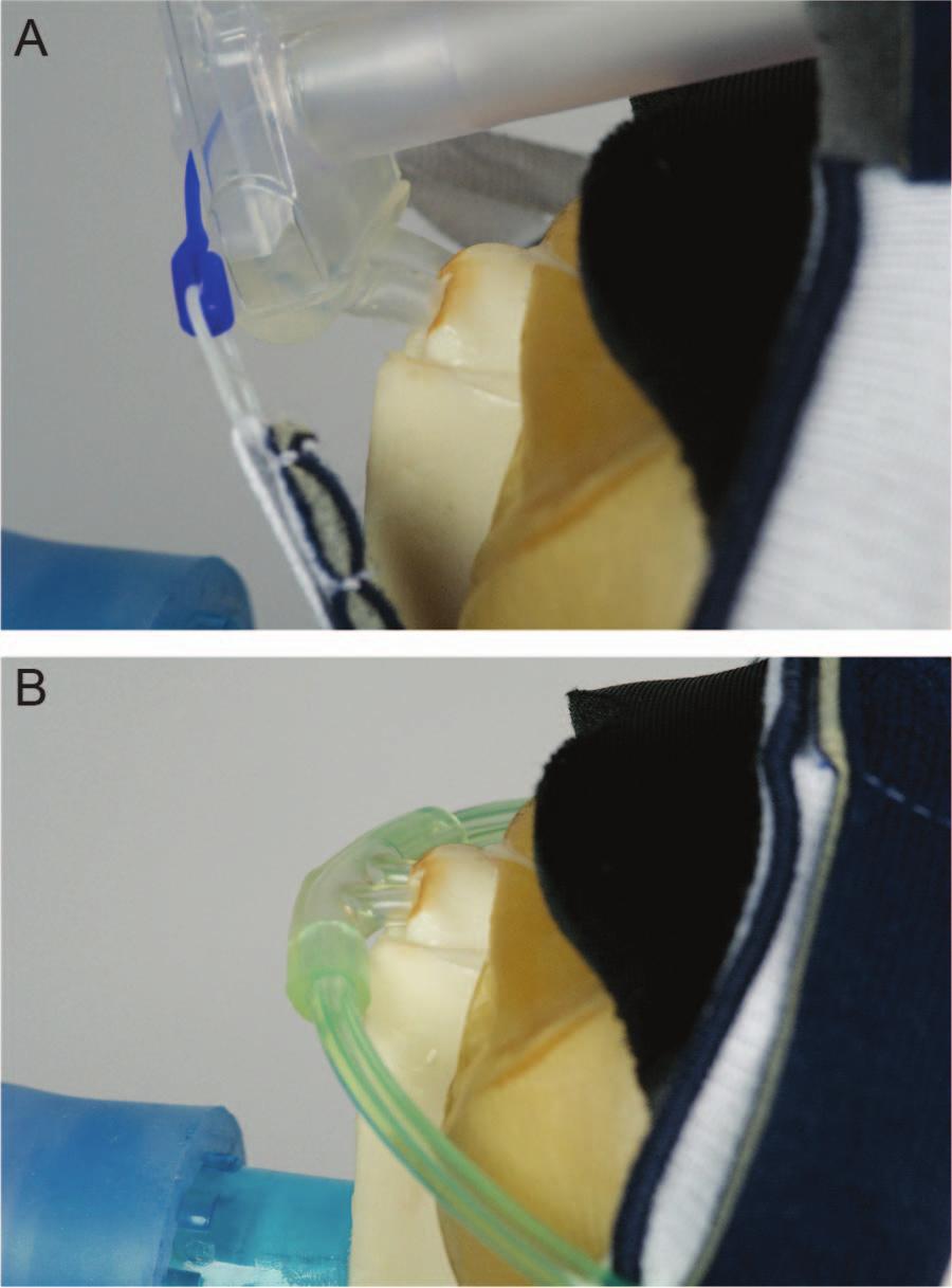 Fig. 2. Illustration of the interfaces attached to the physical model and lung simulator. A: Fisher & Paykel nasal prongs secured with bonnet.