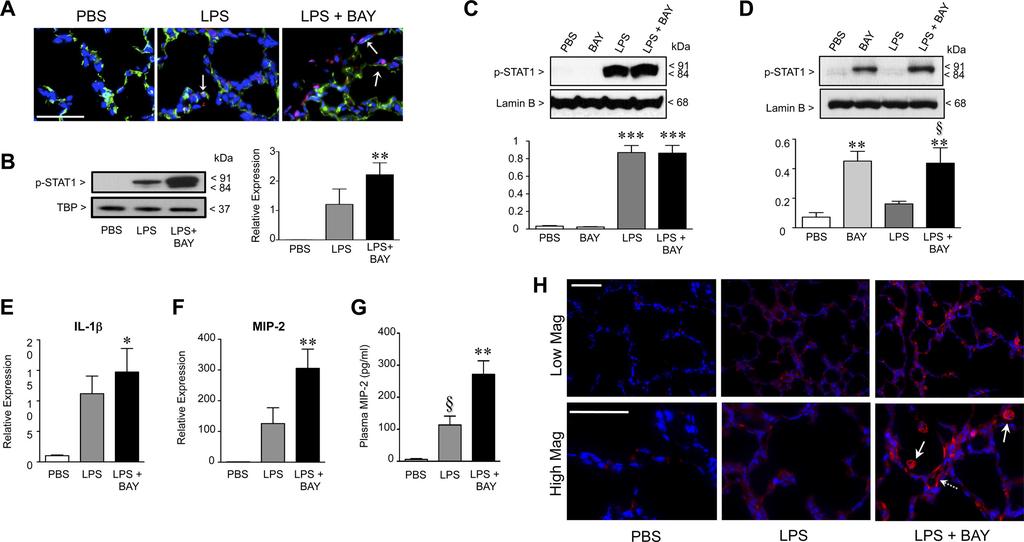 L598 Fig. 4. Inhibiting the NF- B pathway in the early alveolar lung enhances activation of signal transducer and activator of transcription (STAT)-1 and increases LPS-mediated inflammation.