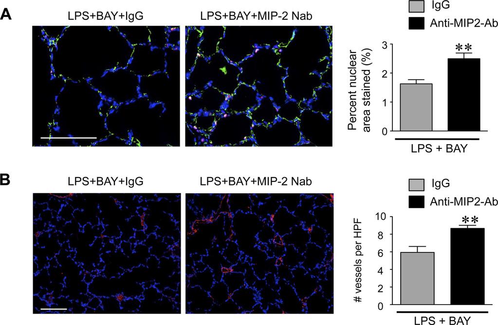 L600 Fig. 6. MIP-2 neutralization prevents the suppressed proliferation and angiogenesis induced by inhibiting the NF- B pathway in the LPS-exposed lung.
