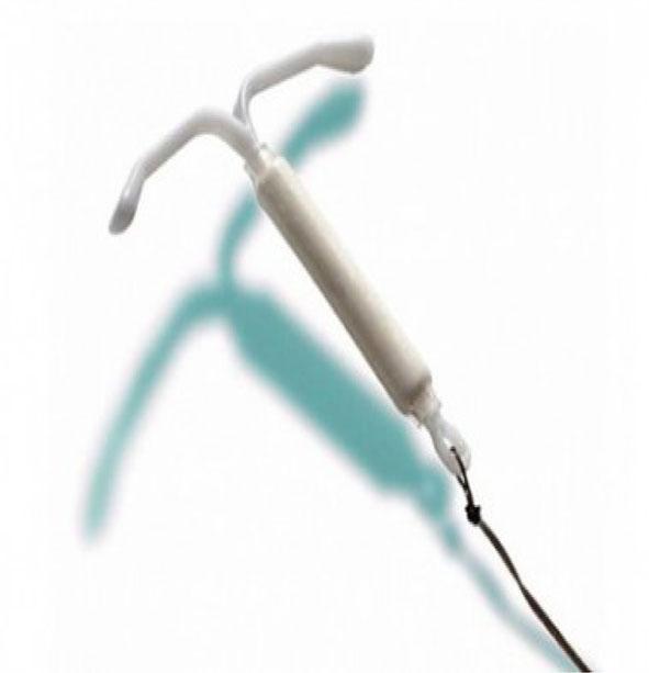 Permanent Sterilisation to Long-Acting Reversible The relative risk of pelvic inflammatory disease (PID) is increased only in the first 20 days after IUD insertion and then returns to baseline, while