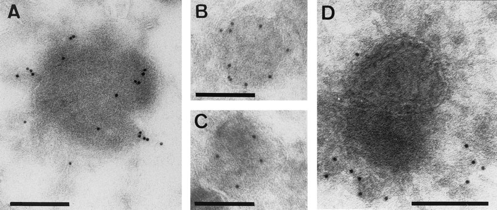 8330 SANCHO ET AL. J. VIROL. FIG. 9. Examples of p16-labeled membrane-rich vesicles in HeLa cells infected with MVA. Cells were fixed at 4 h 30 min(a to C) or 8 h (D) postinfection. Bars, 200 nm.