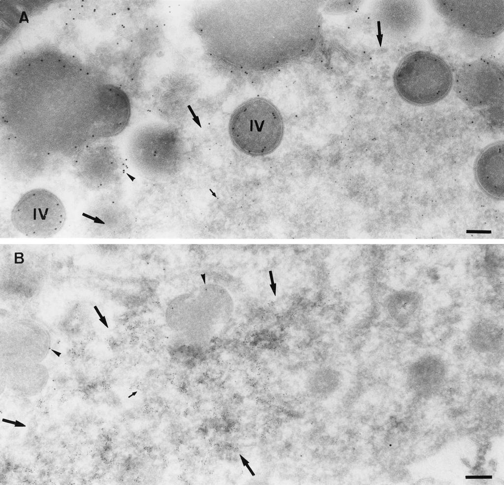 VOL. 76, 2002 MVA MORPHOGENESIS IN HeLa CELLS 8331 FIG. 11. BHK cells infected with MVA and fixed at 5 h postinfection.