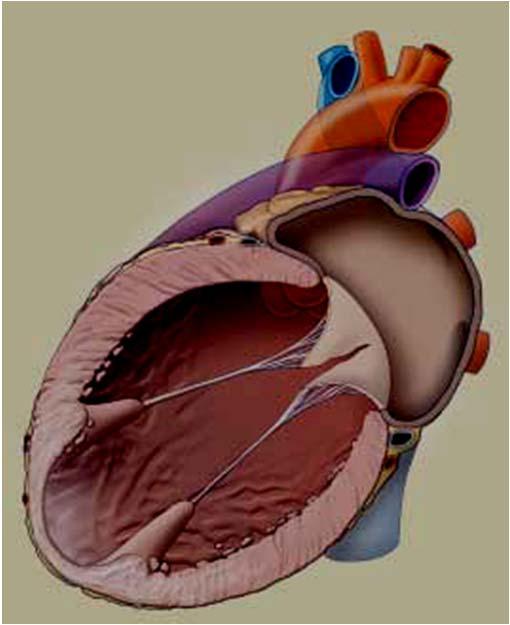 Cell Death infarct expansion LV dilation LV
