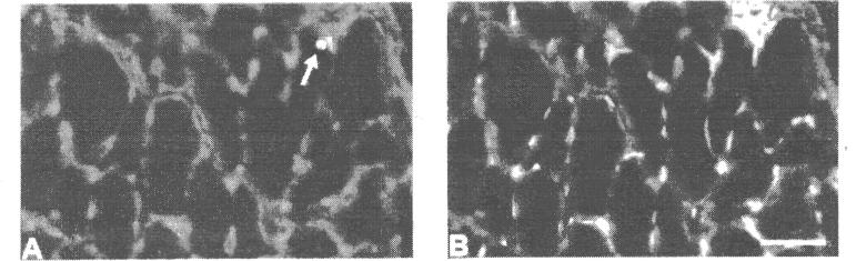 Results The control muscles showed regular pattern and shape of fibres, seen in the cryostat-sections both stained with hematoxylin-eosin (Fig. 1 a) and immunolabelled (Fig. 2a, 3a, b).