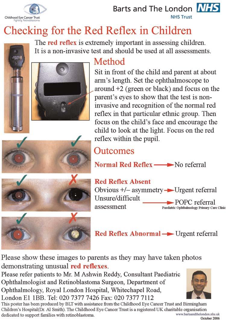 Red reflex assessments Figure 1 Abnormal red reflex information poster Six (46%) admitted seeing the poster and confirmed it was a prompt for referral.