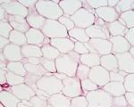 15 Identify this tissue, be specific: c Identify this cell (black circle) d What type of matrix is found in this tissue?