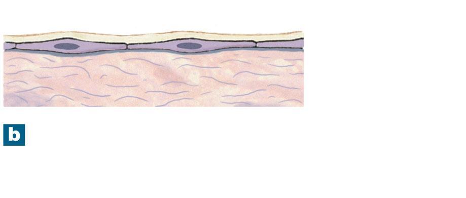 Figure 4-16b Membranes Transudate Mesothelium Areolar tissue Serous membranes