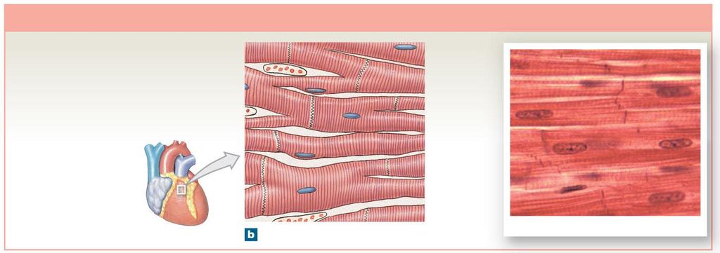 Figure 4-18b Muscle Tissue Cardiac Muscle Tissue Cells are short, branched, and striated, usually with a single nucleus; cells are interconnected by intercalated