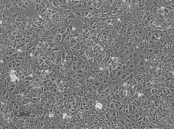 Cell line: ChiPSC18 Flattened