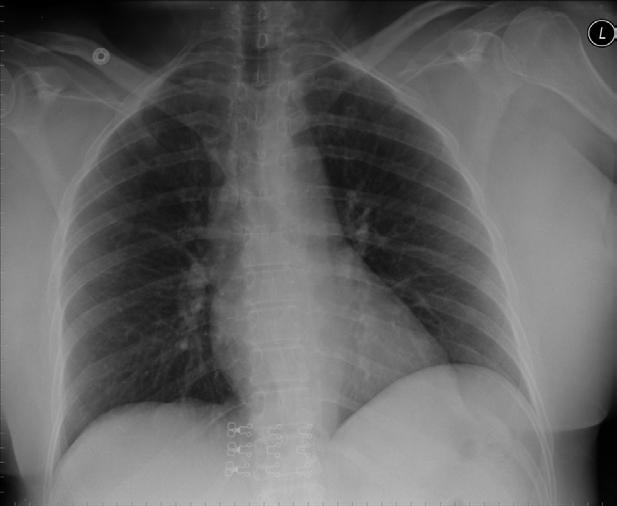 Case 4: 64-year-old female with cough and shortness of breath Presentation material