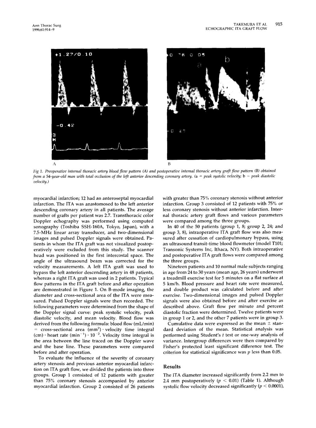 Ann Thorac Surg TAKEMURA ET AL 915 1996;61:914-9 ECHOGRAPHC TA GRAFT FLOW A Fig 1.