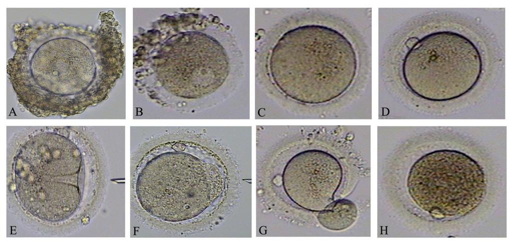 118 Enhancing Success of Assisted Reproduction during the procedure [8]. The embryologist performing ICSI procedure is a significant predictor of fertilization, and laboratory conditions (i.e. incubators, culture of oocytes individually versus grouped) do not affect the rates [9].
