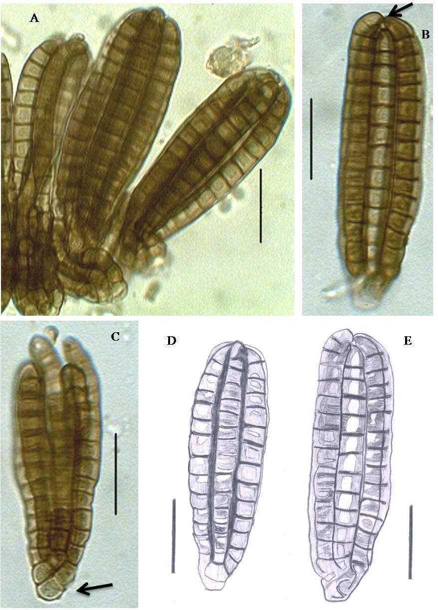 Journal on New Biological Reports 3(3): 159 166 (2014) Fig. 2. Dictyosporium heptasporum A. Crush mount of Sporodochia B.