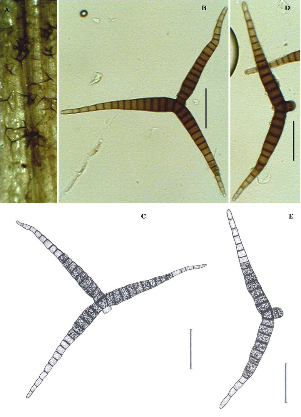 Journal on New Biological Reports 3(3): 159 166 (2014) Fig: 5 Ceratosporium fuscescens A.