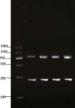 Expression of REGγ mrna Experimental results of RT-PCR were as follows. The total RNAs of 4 cell lines were extracted 3 straps from each cell line, i.e. RNA28S, 18S and 5S and all extracted RNA could be seen in electrophoresis (Fig.