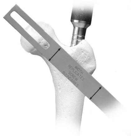 Lag Screw Positioning The projected path of the Lag Screw into the Femoral Head should be assessed using the C-arm (Fig. 26). This may be verified using the Screw Position Outrigger and the 3.