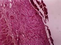 A) Epidermis. B) Dermis with normal structure (H & E 1). study met the requirements of USP 23 regulations for quality control (Table 1).