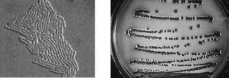 Microbial Pathogenesis How do E.coli become pathogens? Commensal flora Acquire genes that cause disease How do bacteria cause disease?