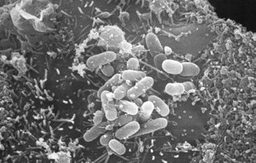 Enteropathogenic E.coli E. coli - bundle forming pilus! Enteropathogenic E.coli pink = gram negative rod M. Donnenberg, Univ. Maryland Enteropathogenic E.