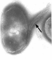 secretion genes SYRINGE GENES Pedestal - attaching/ effacing lesion Intimin expression - adhesin Tir - bacterially encoded receptor. Enteropathogenic E.