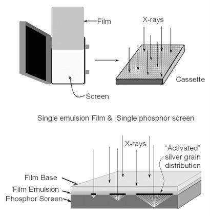 Mammography Equipment - Screen-Film Systems