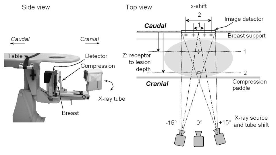 Mammography Equipment - Stereotatic Biopsy Mammography