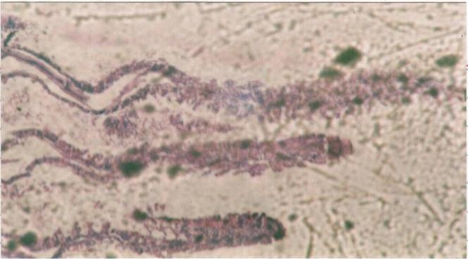 HISTOPATHOLOGY OF GILLS EXPOSED BY LEAD 65 Damage leading to degeneration of epithelial lining in secondary lamellae was clear (Fig. 4.1).