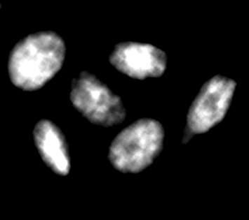 on the left represents the positive control of nuclei of cells exposed to UVA/VIS light