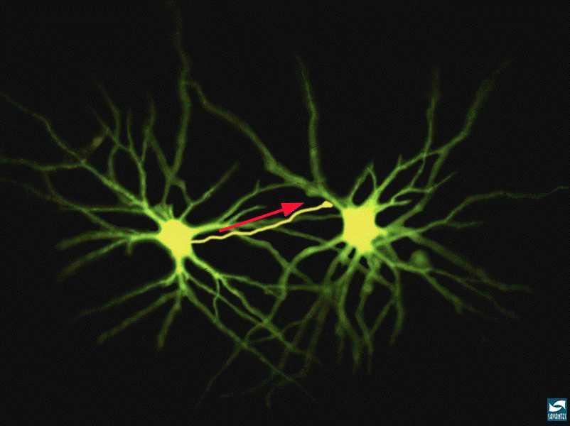 The Synapse Here is a picture of two neurons, with an arrow pointed at one of many synapses In the tiny