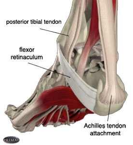 Posterior tibial tendonitis Achilles tendon: plantar flexes the foot (brings the foot down and assists in "push off" when walking).