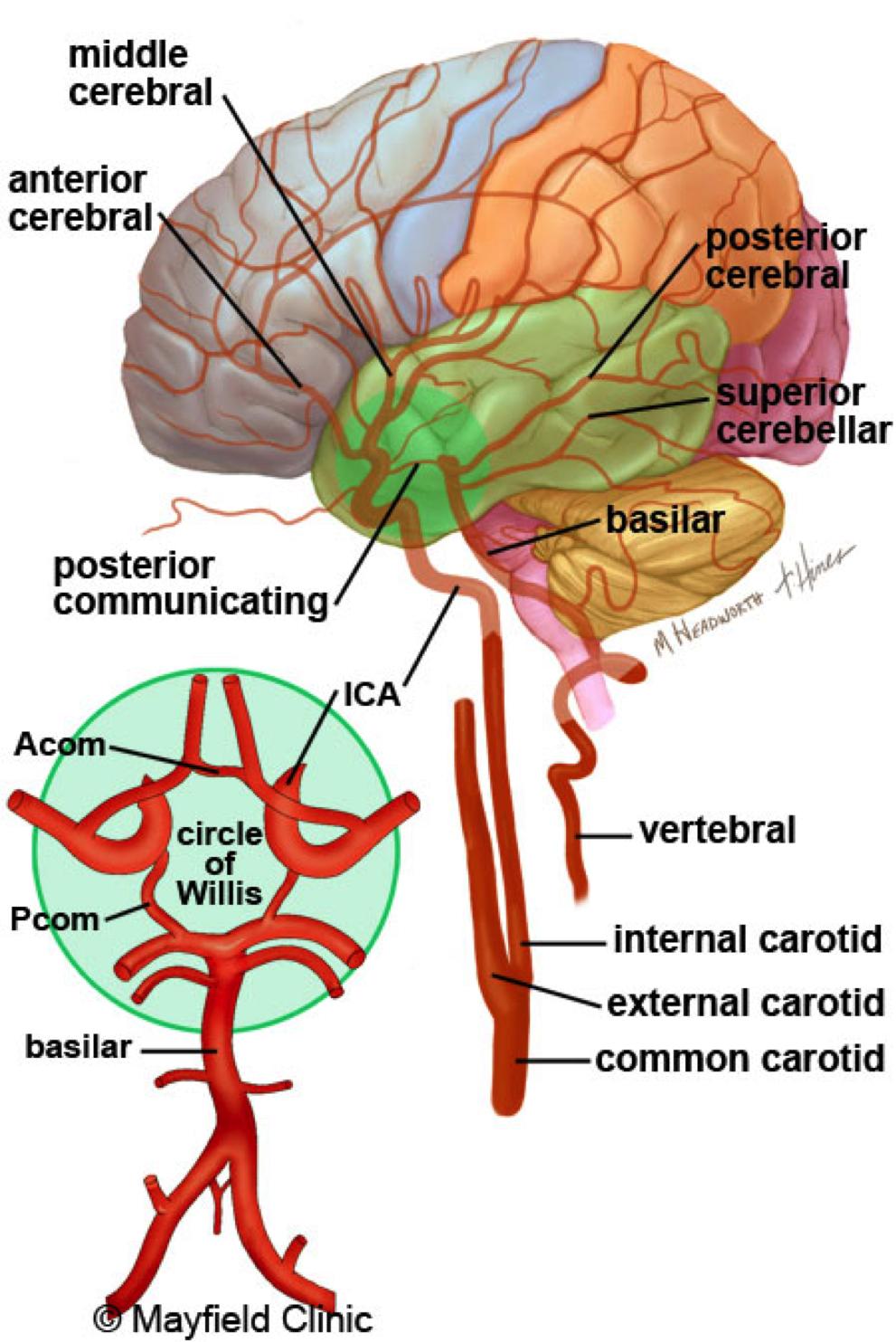 1 Stroke (brain attack) Overview Think of a stroke as a "brain attack" it is an emergency! When symptoms appear, call 911 immediately; every minute counts.