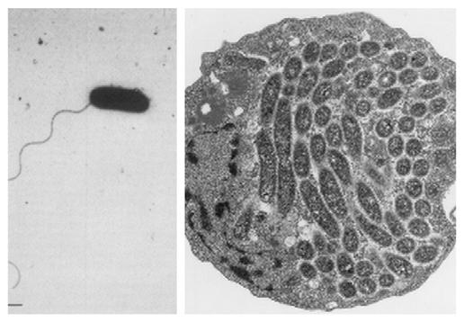 7 Slika 2: Slika bakterije L. pneumophila. (levo) Običkana celica L. pneumophila sg1 (merilo: 1 µm) (Elliott in Johnson, 1981). (desno) Ameba H. vermiformis okužena z bakterijo L.