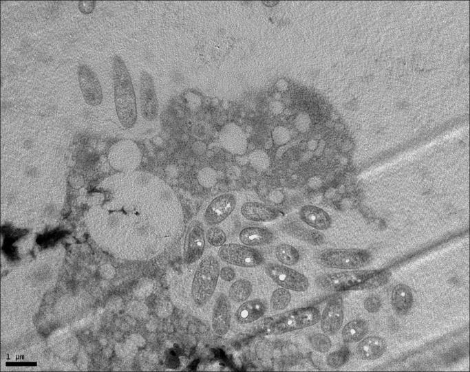 (rdeča puščica) po 24 urah razmnoževanja v monocitih (manjša povečava; merilo: 5 µm) Slika