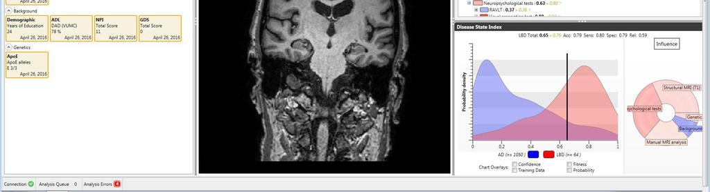 gegevens Ruwe MRI