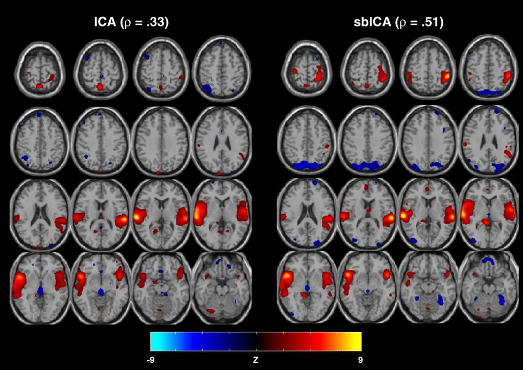 V.D. Calhoun et al. / NeuroImage 25 (2005) 527 538 533 regressor. The data for each of the 20 participants were each reduced to 30 dimensions using PCA, followed by a sbica analysis with c = 0.
